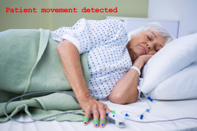 Patient Monitoring
