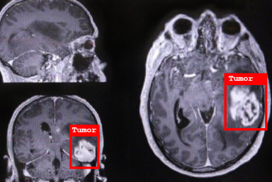 Disease Detection, Diagnosis, and Treatment